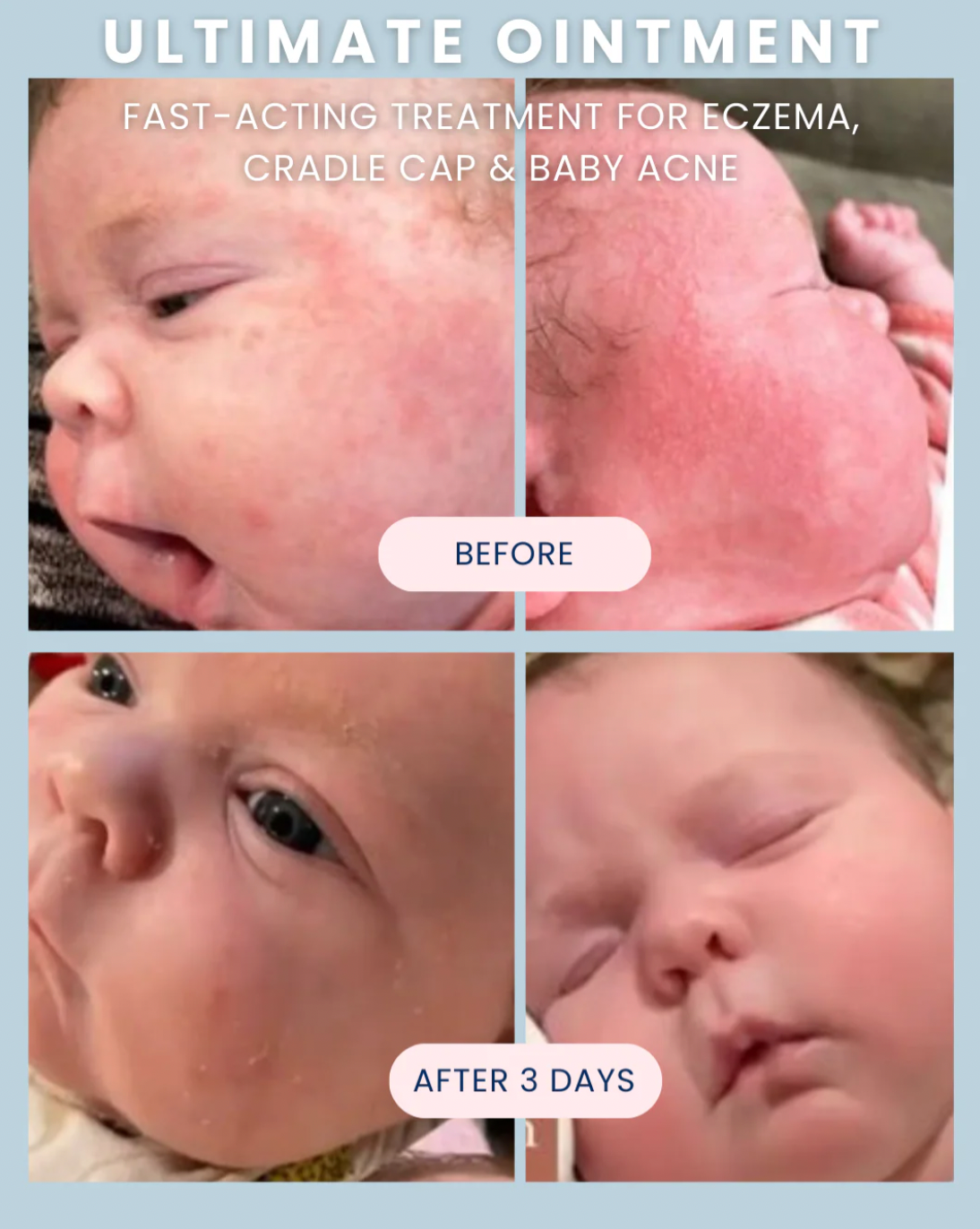 Ultimate Baby Ointment